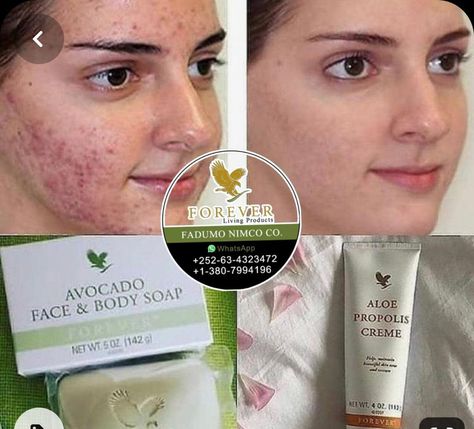 Forever Aloe Gel, Forever Living Company, Aloe Vera Gel Forever, Forever Company, Aloe On Face, Forever Living Business, Forever Living Aloe Vera, Aloe Vera Benefits, Aloe Vera Skin Care