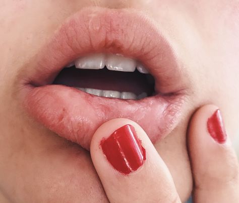 Pulling Lip Reference, Cracked Lips Aesthetic, Chapped Lips Aesthetic, Lenore Castlevania, Chapped Lips Remedy, Ricky Montgomery, Evermore Era, Finger Pull, Photography Subjects