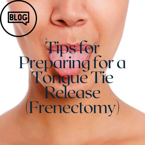 Tips For Preparing For a Tongue Tie Release Tongue Thrust, Myofunctional Therapy, Jaw Pain, Tongue Tie, Surgery Recovery, Nasal Congestion, Poor Posture, Educational Videos, Neck Pain