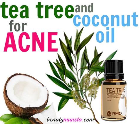 Tea Tree Oil and Coconut Oil for Acne - How to Use with 3 Recipes Coconut Oil Lotion, Tea Tree Oil For Acne, Diy Coconut Oil, Coconut Oil For Dogs, Coconut Oil For Acne, Coconut Oil Skin Care, Coconut Oil Recipes, Coconut Oil Hair Mask, Coconut Oil For Face