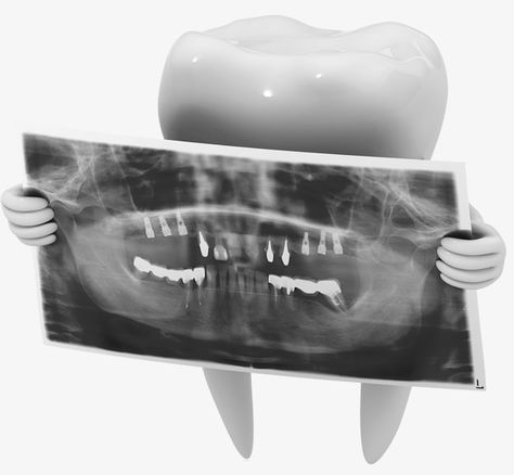 Dental Xrays, Dental X Ray, Film Png, Dental Advertising, Dentist Art, Dental Clinic Logo, Ray Film, Dental Fun, Clinic Logo