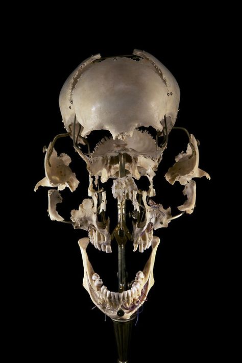 Someday... I will have my own beauchene skull. They're beautiful! Beauchene Skull, Exploding Skull, Servo Skull, Servo Skull Art, Animal Skull Still Life, Decaying Skeleton, Skeleton Scientific Illustration, Mind Blowing Images, Deformed Skull