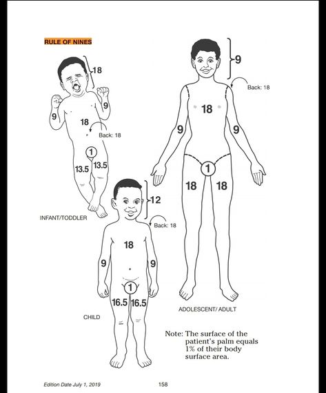 Rule of 9s - how to calculate burn percentages Paramedic Study, Nursing Study Guide, Emt Paramedic, Medical Training, Medical School Essentials, Nursing Study, Medical Knowledge, Nclex, School Essentials