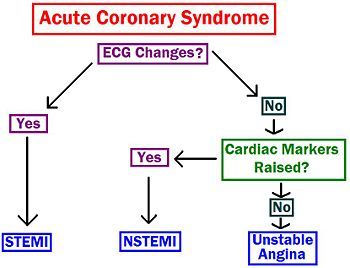 Acute coronary syndrome - MedRevise Acute Coronary Syndrome Nursing, Stemi Vs Nstemi, Endocrine Pharmacology, Cardiology Notes, Nursing Math, Er Nursing, Medicine School, Acute Coronary Syndrome, Pharmacy Student