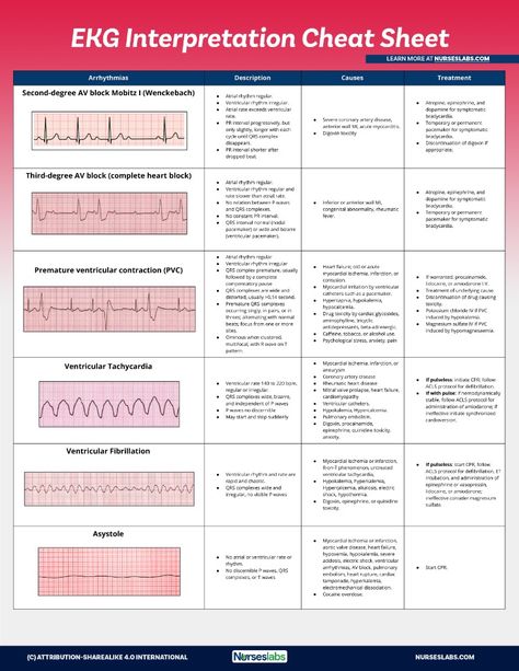 Use this EKG interpretation cheat sheet that summarizes all heart arrhythmias in an easy-to-understand fashion. Ekg Rhythms Cheat Sheets, Ekg Cheat Sheet, Arrhythmias Nursing Cheat Sheets, Easy Ekg Interpretation Cheat Sheets, Heart Rhythm Nursing Cheat Sheets, Telemetry Nursing Cheat Sheets, Ekg Interpretation Made Easy Cheat Sheets, Acls Cheat Sheet 2023, Acls Cheat Sheet 2019