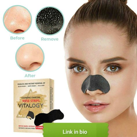 Instantly Removes Dirt, White Heads Removal & Black Head Remover Black Head Removal, Age Spots On Face, Nose Pore Strips, Nose Pores, Blackheads Removal, Nose Strips, White Head, Moisturizer For Oily Skin, Pore Cleansing