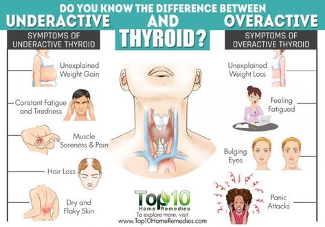 difference between underactive and overactive thyroid Panic Attack Remedies, Low Thyroid Remedies, Enlarged Thyroid, Thyroid Remedies, Overactive Thyroid, Thyroid Healing, Top 10 Home Remedies, Low Thyroid, Thyroid Symptoms