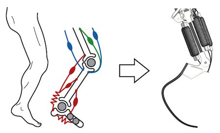 Prosthetic Leg Types | ... uses prosthetic blades, of the type that double amputees use to run Robotic Prosthetics, Leg Types, Prosthetic Limbs, Prosthetic Leg, Body Map, Health Tech, Cyberpunk Character, Mechanical Design, Cool Tech