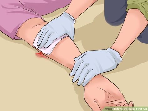 First Aid Steps, First Aid For Burns, First Aid Procedures, Basic First Aid, Sports Injury, Activity Days, Work Environment, Save Life, Emergency Preparedness