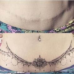 Lower Stomach Tattoos For Women, Lower Belly Tattoos, Lower Stomach Tattoos, Tummy Tattoo, Stomach Tattoos Women, Mastectomy Tattoo, Tattoos To Cover Scars, Waist Tattoos, Belly Tattoos