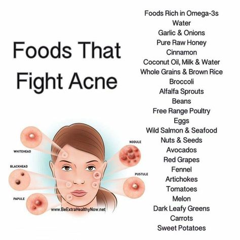 foods that fight acne Acne Safe Foods, Clear Skin Care, Haut Routine, Face Skin Care Routine, Good Skin Tips, Basic Skin Care Routine, Clear Skin Tips, Perfect Skin Care Routine, Healthy Skin Tips