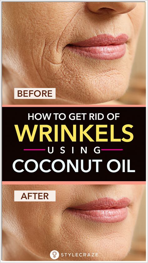 Get ageless skin with Amazon's top-rated anti-aging products, made with natural ingredients for a youthful complexion. Get Rid Of Wrinkles, Skin Care Wrinkles, Baking Soda Shampoo, Beauty Tips For Face, Natural Beauty Tips, Best Anti Aging, Anti Aging Skin Products, Aging Skin Care, Facial Care