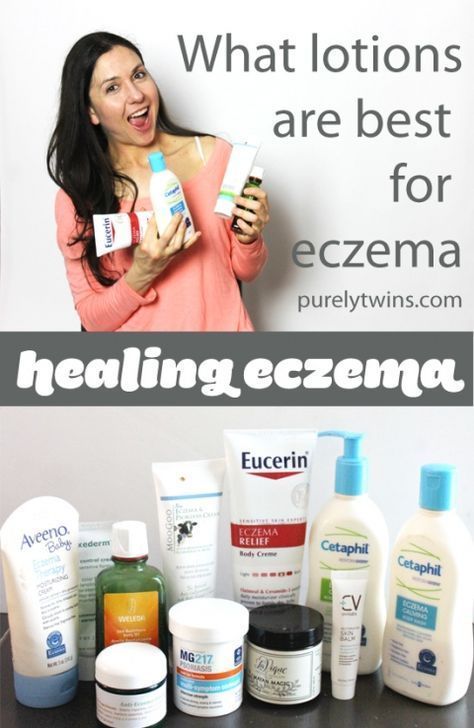 What lotions and products are best to heal eczema. #InstantCelluliteRemoval Haut Routine, Dry Itchy Skin, Skin Disorders, Skin Allergies, Skin Remedies, One Day At A Time, Skin Routine, Itchy Skin, Skin Healing