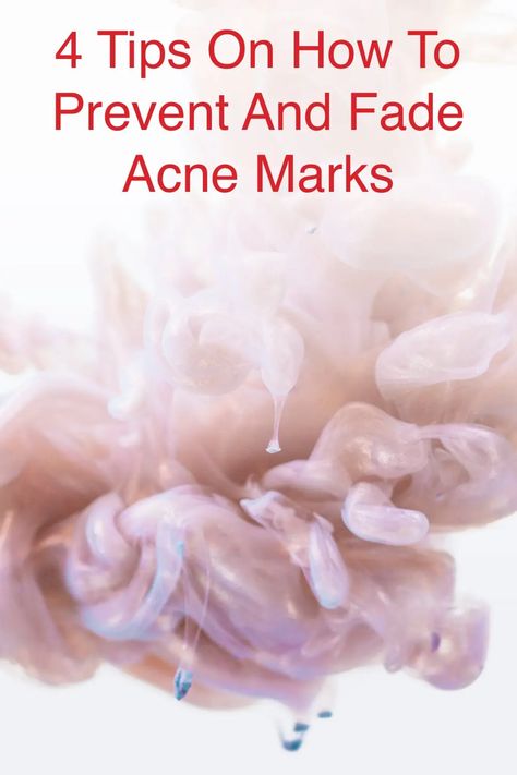 Since we know how a pimple mark appears, the best way to fade it is prevention Pimple Healing, Red Acne Marks, Fade Acne Marks, How To Fade, Post Inflammatory Hyperpigmentation, How To Reduce Pimples, Pimple Marks, Acne Marks, Prevent Acne