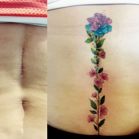 50 Times People Asked To Cover Up Their Scars And Birthmarks, And Tattoo Artists Nailed It Chest Scar Tattoo Cover Up, Surgical Scar Tattoo, Sara Tattoo, Birthmark Tattoo, Wine Glass Tattoo, Tattoo Over Scar, Scar Cover Up, Tattoos To Cover Scars, Scar Tattoo