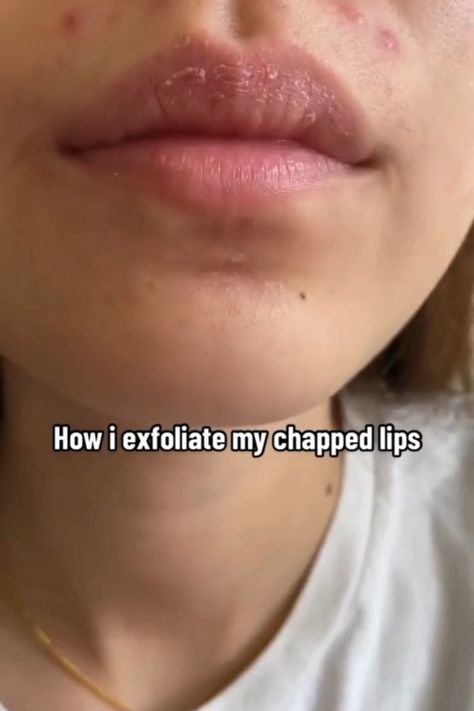 Say Goodbye to Chapped Lips: Essential Tips for Healthy, Soft, and Rosy Lips. Discover how to treat dry lips and stop lips from peeling with these expert tips! Learn effective ways to fix chapped lips and achieve healthier, softer, and more beautiful lips. Whether you need to get rid of smokers lips or simply want to enhance your lip care, these essential tips and tricks will guide you to your best lips yet. #HealthyLips #ChappedLips #LipCare #BeautyTips Tips For Chapped Lips, How To Stop Lips From Peeling, How To Get Rid Of Cracked Lips, How To Heal Cracked Lips, Diy Lip Exfoliator Recipes, How To Treat Dry Lips, How To Fix Chapped Lips, Healthy Lips Tips, How To Heal Chapped Lips Fast