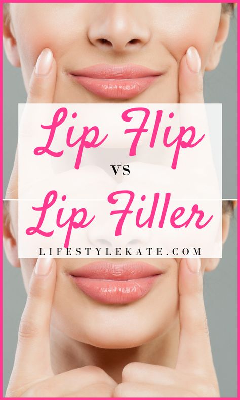 Injection Sites Cheat Sheet, Lip Flip And Filler, Lip Line Filler, Botox Benefits, Botox Lip Flip, Under Eye Filler, Eye Filler, Botox Injection Sites, Dermal Fillers Lips