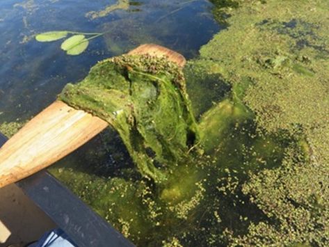 Controlling Pond Algae | Otterbine Pond Algae, Microscopic Organisms, Pond Aerator, Blue Green Algae, Aquatic Ecosystem, Green Algae, Water Pond, Tree Nursery, Surface Water