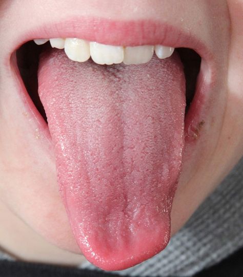 #FunFact #DidYouKnow: Your tongue is the only #muscle in the human body that is attached at one end. Tongue Anatomy, Mouth Anatomy, Human Tongue, Diet Schedule, Taylor Swift Legs, Dental Art, Aloe Vera Plant, Curvy Women Outfits, Dental Services