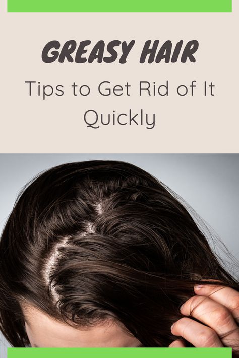 How To Help Greasy Hair, How To Fix Greasy Hair, Greasy Hair Tips, Fix Greasy Hair, Greasy Hair Hairstyles For Work, Greasy Hair Remedies, Prevent Greasy Hair, Bad Hairline, Greasy Hair