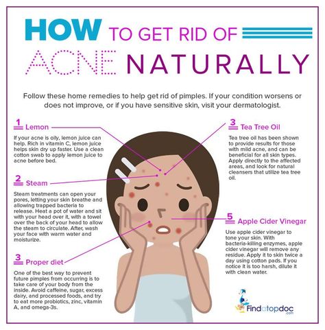 Remove Pimples, Rid Of Pimples, Skin Care Routine For 20s, Get Rid Of Acne, Rid Of Acne, Natural Acne, Types Of Acne, How To Get Rid Of Pimples, How To Remove Pimples