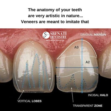 Cosmetic Dentistry Veneers, Virtual Consultation, Dental Images, Porcelain Veneers, Dental Veneers, Cosmetic Dentistry, Clean Girl, Content Creation, Health