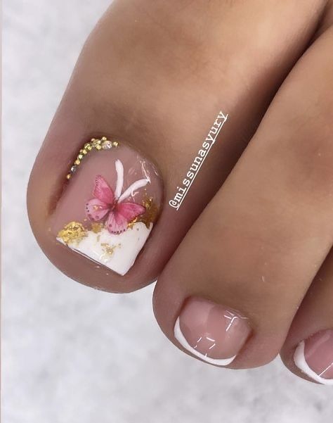 Toenails With Design, White French Nails, Press On Toenails, Fake Toenails, Pedicure Nail Designs, Toenail Designs, Gel Toe Nails, Nail Infection, Acrylic Toes