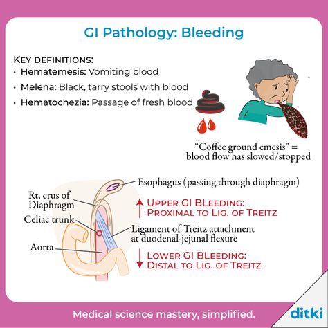 What are some key causes of Upper GI bleeding? Lower GI Bleeding?  Learn more: https://ditki.com/course/pathology/gastrointestinal-pathologies/gi-pathologies-symptom/1726/gi-pathology-bleeding  #ditki #usmle #meded #medschool #medstudent #highered #mededonline #pathology #GIpath #gastroenterology #nursing #pance #physicianassistant #osteopath #allopath #medicine #science #healthscience #nurse #premed #mcat #mbbs Clinical Pathology, Autoimmune Disorders, College Advice, Pre Med, Physician Assistant, Autoimmune Disorder, Med Student, Medical Knowledge, Science Biology