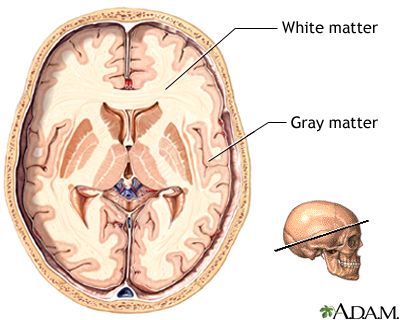 Grey matter is distinguished from white matter, in that it contains numerous cell bodies and relatively few myelinated axons, while white matter contains relatively very few cell bodies and is composed chiefly of long-range myelinated axon tracts.[1] The colour difference arises mainly from the whiteness of myelin. In living tissue, grey matter actually has a very light grey colour with yellowish or pinkish hues, which come from capillary blood vessels and neuronal cell bodies. Nerve Fiber, Brain Facts, White Matter, The Human Brain, Pediatric Therapy, Gray Matters, Speech Language Pathology, Whiplash, Free Life