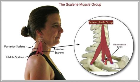 Scalene Muscles Punkty Spustowe, Thoracic Outlet, Psoas Release, Trigger Point Therapy, Wrist Pain, Upper Back Pain, Hand Pain, Hand Therapy, Back Pain Exercises