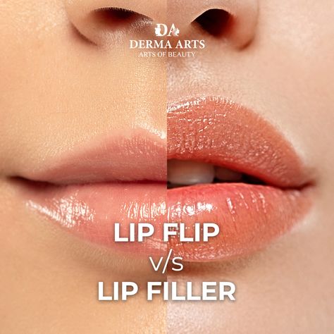 Diving into the world of lip enhancement? 
Let's break it down: Lip flip gently tweaks your smile, while lip filler offers a bolder, plumper look.

Ultimately, the choice between a Lip Flip and Lip Filler depends on your desired outcome and personal preference. 
Whichever option you choose, rest assured that you're one step closer to achieving the perfect pout!

Get Yourself a Perfect Lip at Derma Arts!
📲: +91 9289091212
📍E-4, Greater Kailash 1, New Delhi 110048 Change Lip Shape, What Is A Lip Flip, Lip Filler Social Media, Versa Lip Filler, Lip Filler M Shaped Lips, Letterhead Design Inspiration, Lip Flip, Happy Independence Day India, Independence Day India