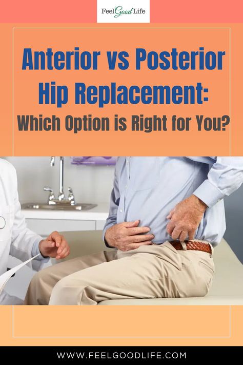 If you need hip replacement surgery, it's important to understand the differences between anterior and posterior approaches. Anterior hip replacement is less invasive and offers a quicker recovery time, while posterior hip replacement has been used for decades and is a tried and true option. In this article, we'll explore the pros and cons of each option and help you make an informed decision. #hipreplacement #anteriorhipreplacement #posteriorhipreplacement #orthopedicsurgery #healthcare Total Hip Surgery, Anterior Hip Surgery, Hip Precautions, Hip Operation, Hip Surgery Recovery, Hip Dislocation, Morning Yoga Stretches, Bursitis Hip, Hip Exercises