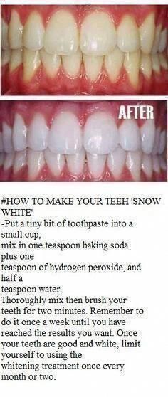 #OralDentalCare #WhatIsMoonOralCare #PreventiveOralHealthCare Make Teeth Whiter, Baking Soda Teeth, Natural Teeth Whitening Diy, Baking Soda Teeth Whitening, Obličejové Masky, Teeth Whitening Homemade, Baking Soda And Lemon, Teeth Whitening Remedies, Teeth Whitening Diy