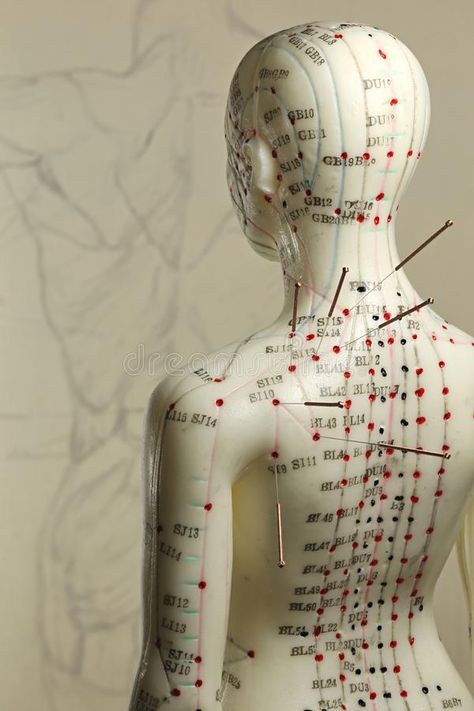 Traditional Chinese Medicine Acupuncture, Acupuncture Points Chart, Tcm Traditional Chinese Medicine, Acupuncture Point, Hurt Pain, Human Body Anatomy, Cupping Therapy, Acupuncture Points, Naturopathy