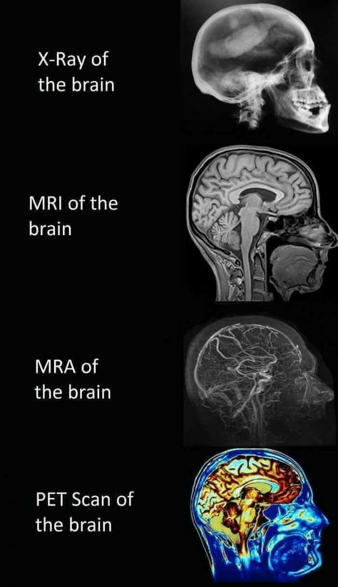 Brain Images, Brain Facts, Medical Student Study, Nursing School Survival, Medical Facts, Nursing School Tips, Medical School Studying, Nursing School Notes, Human Anatomy And Physiology