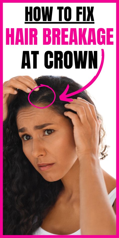 Discover the underlying causes, prevention strategies, and effective solutions for hair breakage at the crown. Achieve healthier and more harmonious hair with these actionable insights. Fix Hair Breakage, Traction Alopecia, Stop Hair Breakage, Breaking Hair, Curly Hair Problems, New Hair Growth, Healthy Hair Tips, Hot Hair Styles, Hair Problems