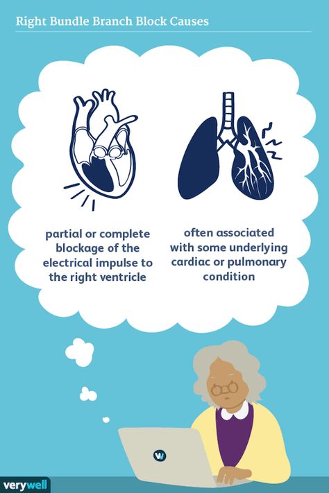 Overview of Right Bundle Branch Block (RBBB) Bundle Branch Block, Heal Leaky Gut, Congenital Heart Defect, Heart Blocks, Reflux Disease, Heart Function, Heart Muscle, Journal Prompts, Pattern Blocks