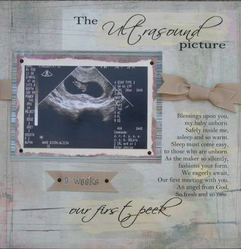 Pregnancy Scrapbook Ideas, Ultrasound Scrapbook, Scrapbook Baby Book Ideas, Baby Journal Book, Pregnancy Scrapbook, Baby Book Ideas, Baby Book Pages, Baby Scrapbook Layouts, 3d Ultrasound