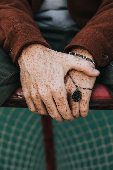 Kendal, unique, accessory and bracelet HD photo by Nathan Dumlao (@nate_dumlao) on Unsplash Freckles On Hands, Kyle Bloodworth, Poisonous Insects, Charlie Aesthetic, Reference Hands, Central Heterochromia, Degree Burns, The Heist, Free High Resolution Photos