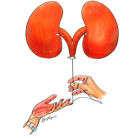 #organ_donation #mathrubhumi #vijeshviswam Kidney Donation Poster, Transplant Party, Organ Donation Poster, Kidney Donation, Kidney Stone, Organ Transplant, Organ Donation, Men's Health Fitness, Deep Meaning