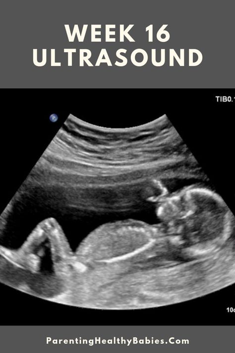 15 Weeks Pregnant Facts, 17 Weeks Pregnant Ultrasound, 22 Week Ultrasound, 15 Week Ultrasound, Boy Ultrasound Pictures, 4d Ultrasound Pictures, Ob Ultrasound, Boy Ultrasound, 12 Week Ultrasound