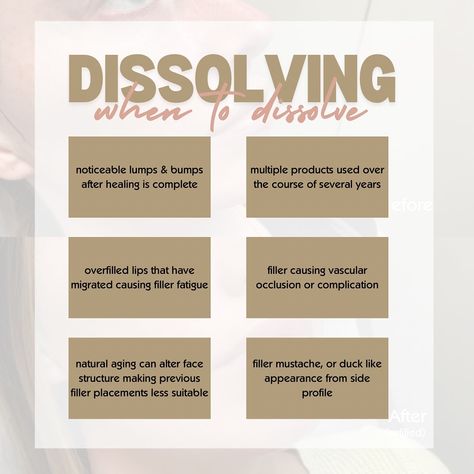 Over time, most HA fillers can migrate no matter what type of filler was used or how good the injectors technique was!  It’s most common when it’s injected near an active muscle (like around the mouth or under eyes)  & because filler can last for such a long time, to prevent filler build up, I usually recommend dissolving every 5(ish) years to return to baseline. This way we can avoid dreaded filler mustache or duck lips 🙂‍↕️ Swipe to see a recent dissolve and refill I did on some lips tha... Duck Lips, Face Fillers, Under Eyes, Natural Aging, Lip Fillers, Med Spa, What Type, No Matter What, Being Used