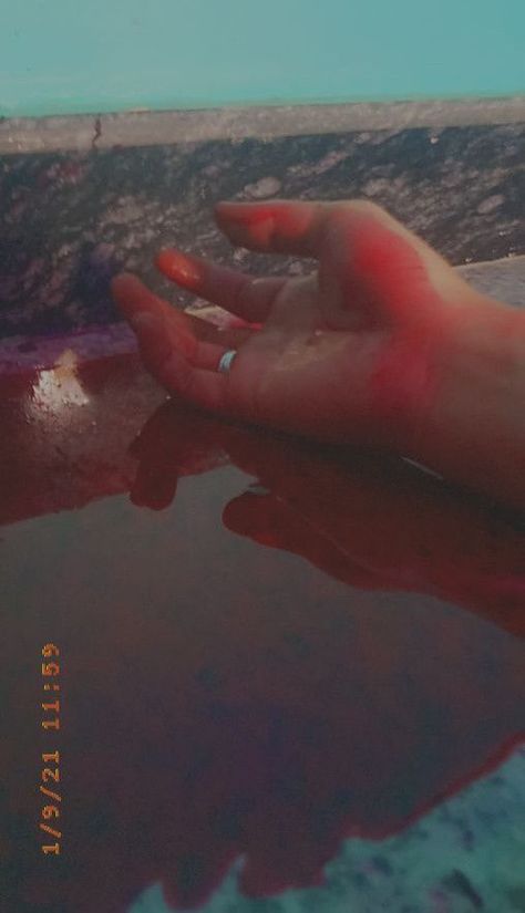 Blood Vomit Status, Hand Blooded Snap, Hand Damage Dpz Boy, Hand Kata Pic Bled, Blood Snapstreaks, Blood Snapchat, Accident Dp, Injury Aesthetic, Burned Hand Pic