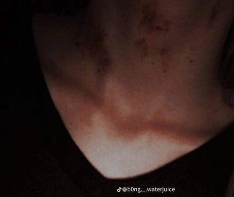 Hickies Neck Boys And Girl, Hickies Neck Aesthetic Guy, Kissing Clips, Hickies Neck Aesthetic, Hickies Neck, Neck Aesthetic, Aesthetic Guy, Delsin Rowe, Kiss Mark