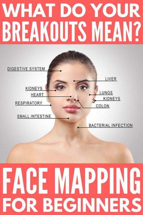 Your complete breakout map guide! If you haven’t heard of face mapping, take note! The location of your acne and breakouts isn’t random, it can actually tell you a lot about your health. If you struggle with bad skin and have exhausted all of the products and natural remedies that promise to get rid of acne without success, we’re sharing our best tips to help you understand what your breakouts mean and what you can do to control and (hopefully) eliminate them completely. Breakout Map, Gesicht Mapping, Doterra Acne, Face Mapping Acne, Bad Skin, Face Mapping, Get Rid Of Acne, Rid Of Acne, Natural Acne Remedies