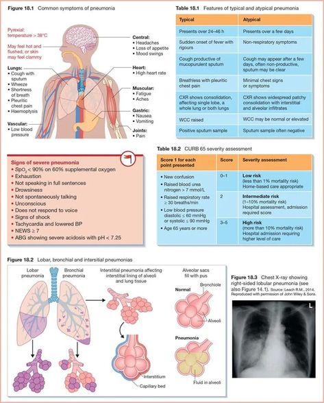 Nursing Respiratory, Medical Laboratory Science Student, Nursing School Organization, General Physician, Physician Assistant School, Nursing Journal, Nursing 101, Heart Rhythm, Nursing School Essential