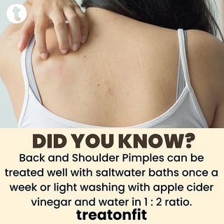 Mother Nature Heals on Instagram: “Double tap If you want more posts like this ❤🙏 . Follow our new page @betterremedies for natural remedies and much more 🙏 . Tag someone…” Arm Pimples, Keratosis Pilaris, Home Health Remedies, Vinegar And Water, Upper Arms, Home Health, Health Remedies, Double Tap, Natural Healing