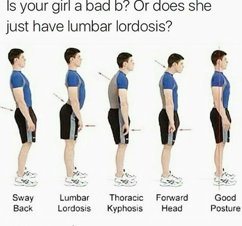 Lumbar Lordosis, Posture Fix, Fitness Hacks, Forward Head Posture, Pelvic Tilt, Posture Exercises, Mobility Exercises, Bad Posture, Better Posture