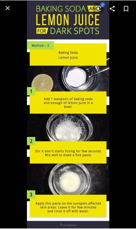 The Benefits of Baking SodaBaking soda is an incredibly versatile and affordable product that can be used for all sorts of cleaning tasks around the home. From freshening up laundry to unclogging... Baking Soda And Lemon Underarm, Lemon And Baking Soda, Benefits Of Baking Soda, Baking Soda Lemon Juice, Potato Juice, Baking Soda Benefits, Baking Soda And Lemon, Skin Shine, Brighter Skin