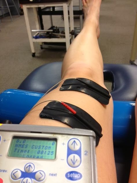 Blog about ACL surgery and recovery. http://britearsheracl.blogspot.ca/ Knee Surgery Recovery, Acl Surgery, Broken Ankle, Leg Cast, Airplane Window, Scammer Pictures, Doctor Picture, Knee Surgery, Surgery Recovery